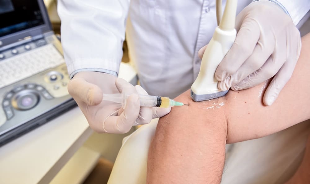 Ultrasound Guided PRP Injection in UK Essex